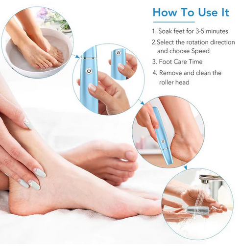 New Electric Foot File, Callus Remover for Cracked Heels, Portable Pedicure Kit with Replacement Heads
